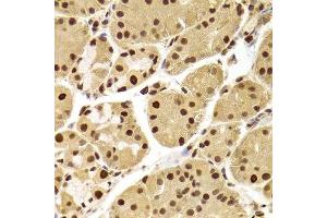 Immunohistochemistry (Paraffin-embedded Sections) (IHC (p)) image for anti-Acidic (Leucine-Rich) Nuclear phosphoprotein 32 Family, Member A (ANP32A) (AA 1-170) antibody (ABIN6136909)