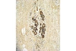 Immunohistochemistry (Paraffin-embedded Sections) (IHC (p)) image for anti-Receptor Tyrosine-Protein Kinase ErbB-3 (ERBB3) (AA 24-55), (N-Term) antibody (ABIN391949)