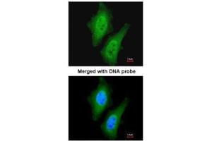 ICC/IF Image Immunofluorescence analysis of paraformaldehyde-fixed HeLa, using LOC169436, antibody at 1:200 dilution. (C9orf96 antibody  (C-Term))