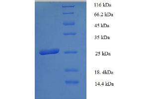 HLA-DPB1 Protein (AA 30-225, Extracellular) (His tag)
