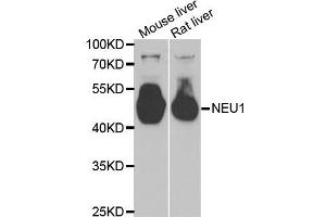 Western blot analysis of extracts of various tissues, using NEU1 antibody (ABIN5973721) at 1/1000 dilution.