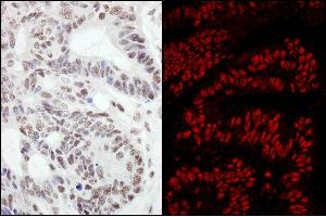 Immunohistochemistry (IHC) image for anti-RAN Binding Protein 3 (RANBP3) (AA 150-200) antibody (ABIN7453398)