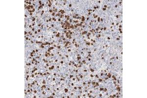 Immunohistochemical staining of human spleen with ZNF227 polyclonal antibody  shows strong cytoplasmic positivity in subsets of cells in red pulp at 1:500-1:100 dilution. (ZNF227 antibody)