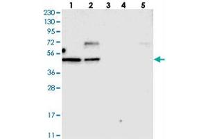 Western blot analysis of Lane 1: RT-4, Lane 2: U-251 MG, Lane 3: Human Plasma, Lane 4: Liver, Lane 5: Tonsil with TOX polyclonal antibody . (TOX antibody)