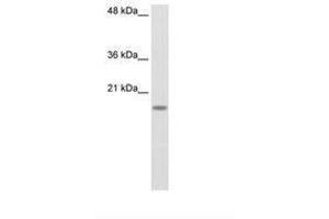 Image no. 1 for anti-Ribosomal Protein S14 (RPS14) (C-Term) antibody (ABIN203014) (RPS14 antibody  (C-Term))