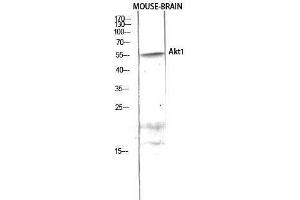 Western Blotting (WB) image for anti-V-Akt Murine Thymoma Viral Oncogene Homolog 1 (AKT1) (Ser1303) antibody (ABIN6281736)