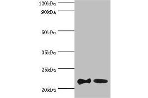 SRI antibody  (AA 1-198)