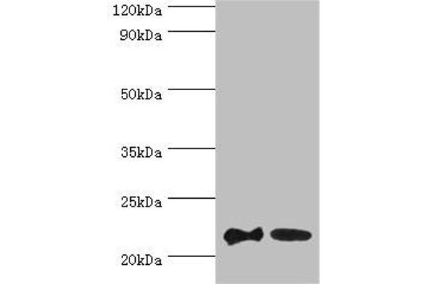 SRI antibody  (AA 1-198)