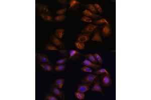 Immunofluorescence analysis of U-2 OS cells using ROBO1 Polyclonal Antibody (ABIN7270110) at dilution of 1:100 (40x lens). (ROBO1 antibody  (AA 1452-1651))