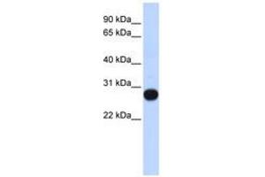 Image no. 1 for anti-Transcription Elongation Factor A (SII)-Like 4 (TCEAL4) (AA 107-156) antibody (ABIN6741080) (TCEAL4 antibody  (AA 107-156))