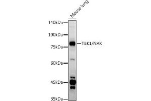 Western blot analysis of extracts of Mouse lung, using TBK1/NAK antibody (ABIN3016267, ABIN3016268, ABIN3016269 and ABIN6219678) at 1:1000 dilution. (TBK1 antibody  (AA 440-729))