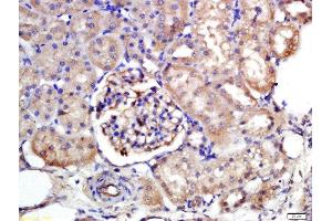 Formalin-fixed and paraffin embedded rat kidney labeled with Rabbit Anti-NTCP/SLC10A1 Polyclonal Antibody, Unconjugated  at 1:200 followed by conjugation to the secondary antibody and DAB staining (SLC10A1 antibody  (AA 21-120))