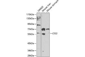 Western blot analysis of extracts of various cell lines, using CES2 antibody (ABIN6134283, ABIN6138436, ABIN6138437 and ABIN6217717) at 1:1000 dilution. (CES2 antibody  (AA 310-410))