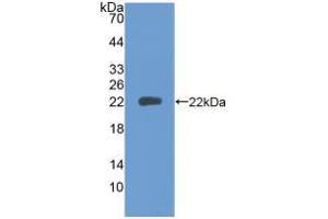 Western blot analysis of recombinant Human PTPRN. (PTPRN antibody  (AA 35-185))