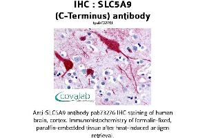 Image no. 1 for anti-Solute Carrier Family 5 (Sodium/glucose Cotransporter), Member 9 (SLC5A9) (C-Term) antibody (ABIN1739408) (SLC5A9 antibody  (C-Term))