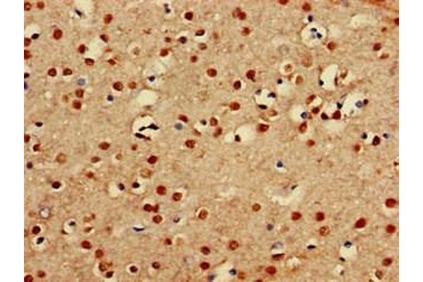 PRDM16 antibody  (AA 448-683)