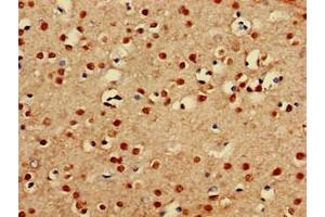 Immunohistochemistry of paraffin-embedded human brain tissue using ABIN7164089 at dilution of 1:100 (PRDM16 antibody  (AA 448-683))