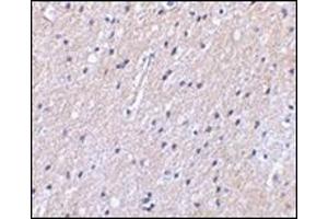 Immunohistochemical staining of human brain tissue using AP30592PU-N at 2. (SLC9A1 antibody  (Center))