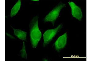 Immunofluorescence of purified MaxPab antibody to AMID on HeLa cell. (AIFM2 antibody  (AA 1-373))