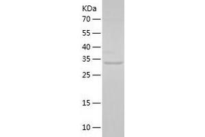 Western Blotting (WB) image for GRB2-Related Adaptor Protein 2 (GRAP2) (AA 1-330) protein (His tag) (ABIN7123200) (GRAP2 Protein (AA 1-330) (His tag))