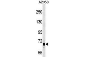 ARHGEF5 Antibody (C-term) western blot analysis in A2058 cell line lysates (35µg/lane). (ARHGEF5 antibody  (C-Term))