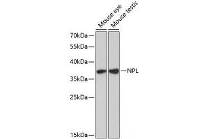 Western blot analysis of extracts of various cell lines using NPL Polyclonal Antibody at dilution of 1:3000.