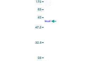 PSMA1 Protein (AA 1-263) (GST tag)