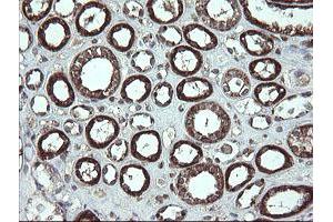 Image no. 9 for anti-Family with Sequence Similarity 164, Member A (FAM164A) antibody (ABIN1498198) (FAM164A antibody)