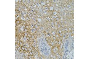 Immunohistochemistry of paraffin-embedded human esophagus using NTF3 antibody (ABIN3017531, ABIN3017532, ABIN3017533 and ABIN6220139) at dilution of 1:100 (40x lens). (Neurotrophin 3 antibody)