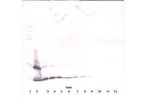 Image no. 2 for anti-PDGF-BB Homodimer antibody (ABIN465590) (PDGF-BB Homodimer antibody)