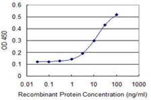 Detection limit for recombinant GST tagged TRIM17 is 1 ng/ml as a capture antibody. (TRIM17 / RNF16 antibody  (AA 75-184))