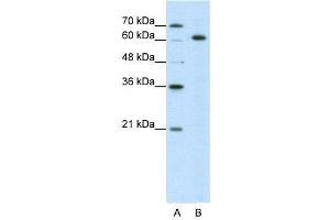 WB Suggested Anti-SNRP70  Antibody Titration: 5. (SNRNP70 antibody  (N-Term))