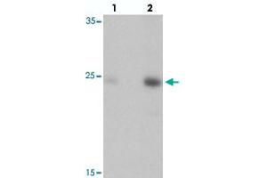 Western blot analysis of DRGX in rat liver tissue with DRGX polyclonal antibody  at (lane 1) 1 and (lane 2) 2 ug/mL. (DRGX antibody  (C-Term))