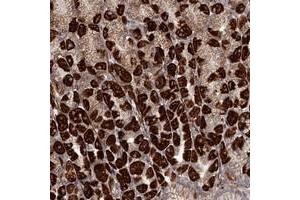 Immunohistochemical staining of human stomach with C6orf153 polyclonal antibody  shows strong cytoplasmic positivity in Parietal cells.