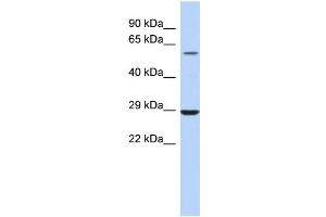 WB Suggested Anti-LPCAT1 Antibody Titration:  0. (LPCAT1 antibody  (Middle Region))