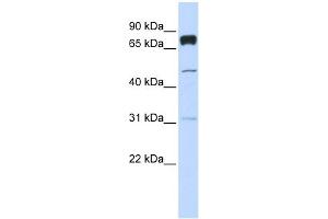 WB Suggested Anti-PLEKHA4 Antibody Titration:  0. (PLEKHA4 antibody  (Middle Region))