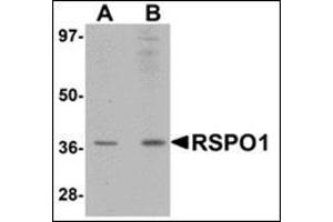 Western blot analysis of RSPO1 in rat spleen tissue lysate with this product at (A) 1 and (B) 2 μg/ml.