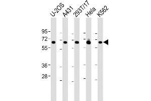 All lanes : Anti-RSL1D1 Antibody (C-Term) at 1:2000 dilution Lane 1: U-2OS whole cell lysate Lane 2: A431 whole cell lysate Lane 3: 293T/17 whole cell lysate Lane 4: Hela whole cell lysate Lane 5: K562 whole cell lysate Lysates/proteins at 20 μg per lane. (RSL1D1 antibody  (AA 455-485))