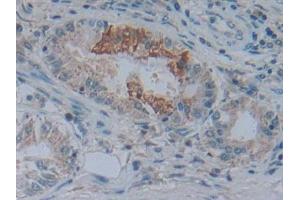 Immunohistochemistry (IHC) image for anti-5'-Nucleotidase, Cytosolic III (NT5C3) (AA 52-336) antibody (ABIN7442483)