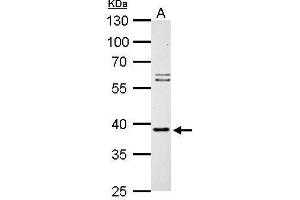 SAE1 antibody