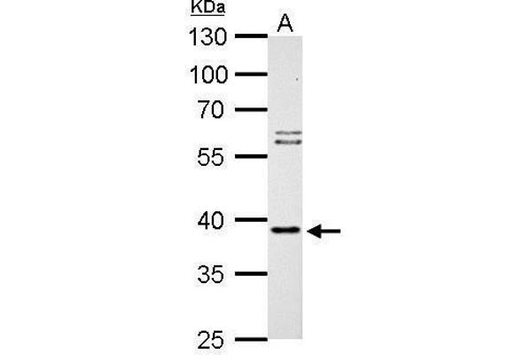 SAE1 antibody