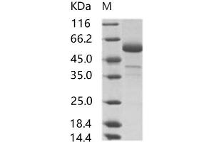 MERS-Coronavirus Spike Protein (MERS-CoV S) protein (rFc Tag)