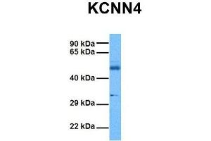 Host:  Rabbit  Target Name:  KCNN4  Sample Tissue:  Human Ovary Tumor  Antibody Dilution:  1. (KCNN4 antibody  (C-Term))
