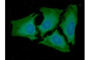 ICC/IF analysis of AK2 in HeLa cells line, stained with DAPI (Blue) for nucleus staining and monoclonal anti-human AK2 antibody (1:100) with goat anti-mouse IgG-Alexa fluor 488 conjugate (Green). (Adenylate Kinase 2 antibody  (AA 1-239))