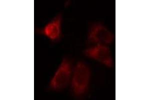 ABIN6275024 staining LOVO cells by IF/ICC.