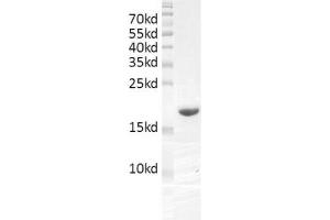 Recombinant SMARCA4 / BRG1 (1448-1569) protein gel. (SMARCA4 Protein (AA 1448-1569) (His tag,DYKDDDDK Tag))