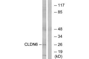 Western blot analysis of extracts from Jurkat cells, using CLDN6 antibody. (Claudin 6 antibody  (Internal Region))