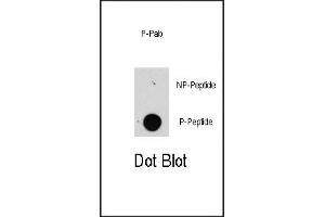 Dot blot analysis of anti-raptor-p Pab (R) on nitrocellulose membrane. (RAPTOR antibody  (pSer863))