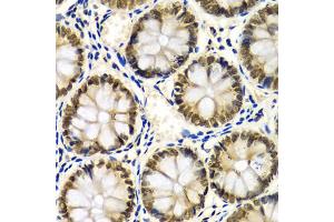 Immunohistochemistry of paraffin-embedded human colon using SNRPE Antibody (ABIN1876676) at dilution of 1:100 (40x lens). (SNRPE antibody)