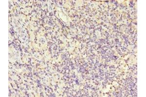 Immunohistochemistry of paraffin-embedded human tonsil tissue using ABIN7163557 at dilution of 1:100 (LCP1 antibody  (AA 2-627))